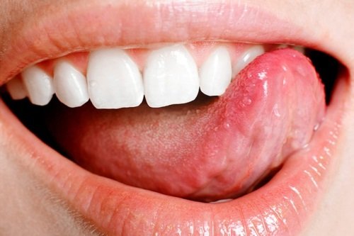 Как вылечить боль на кончике языка