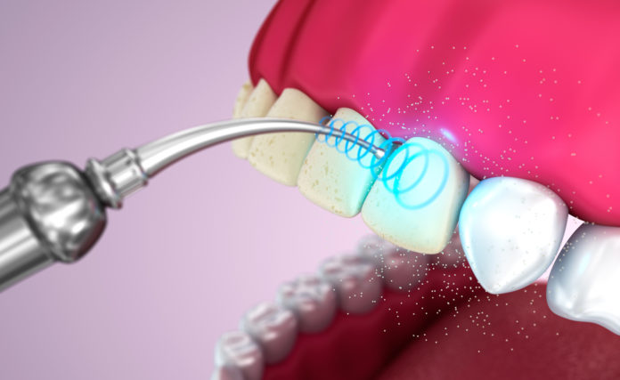Профилактическая чистка зубов