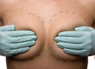 Операция по увеличению груди
