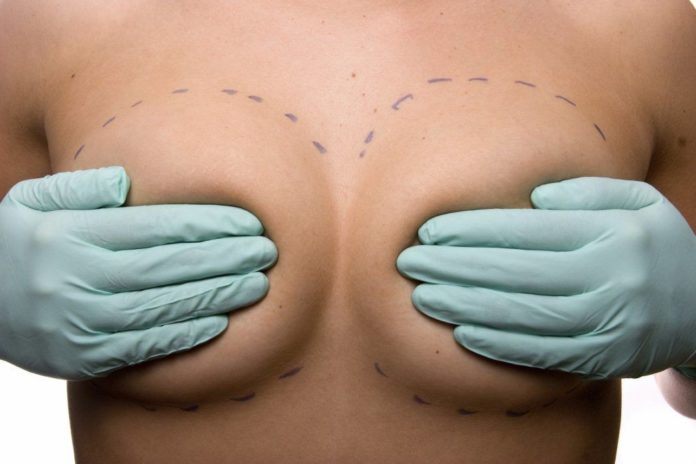Операция по увеличению груди
